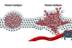Tumores benignos y malignos int