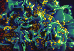 VIH infectando una célula T. Inst. de Enfermedades Infecciosas EU.