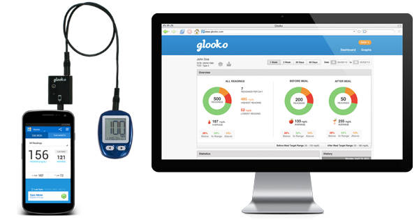 Sistema de Monitorización continua de glucosa ⇨ Controla tu Diabetes