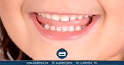 i-fluorosis-dental