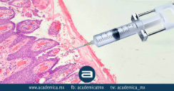 biopsia_piel-I