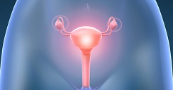 5 cosas importantes sobre el cancer de ovario.2