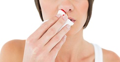 8 causas por las que sangra la nariz.2