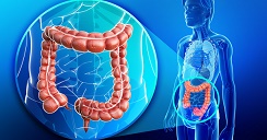 malrotacion intestinal.2