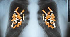 Pacientes con cáncer de pulmón que fuman menos viven más.2
