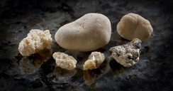 kidney_stones.2