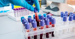 prueba-sangre-cancer-ovario-2