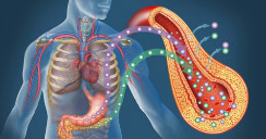 Hipoglucemia