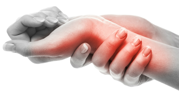 neuropatía