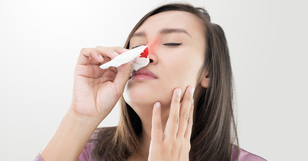 consumo juego sufrir 5 pasos a seguir para detener una hemorragia nasal