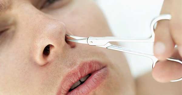 Repegar Condición lavar Vello largo en la nariz: Qué lo causa, beneficios y cómo eliminarlo con  seguridad - ClikiSalud.net | Fundación Carlos Slim