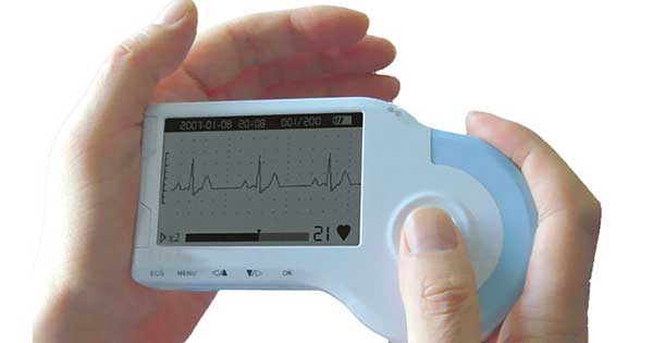 Gorrión distorsión Siempre Monitores de electrocardiograma (ECG) caseros, lo que debes saber